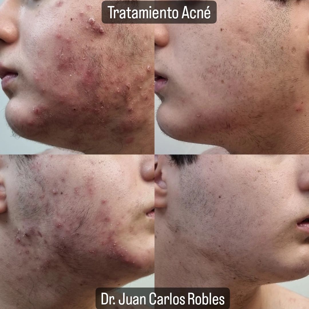 Juan Carlos Robles Méndez-0