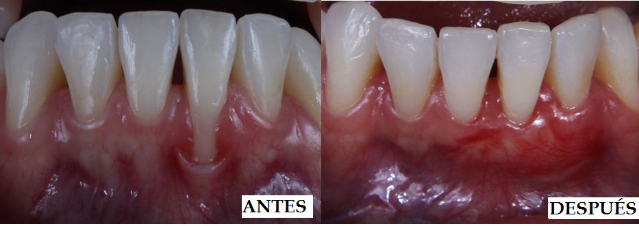 Ireri Rojas Bermúdez-5