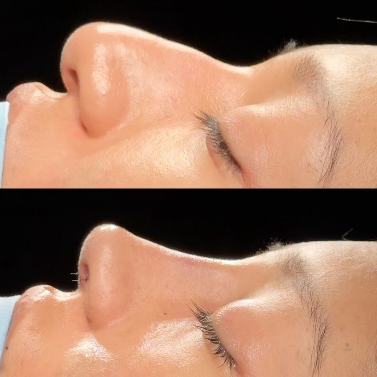 Angel Castro Urquizo-229