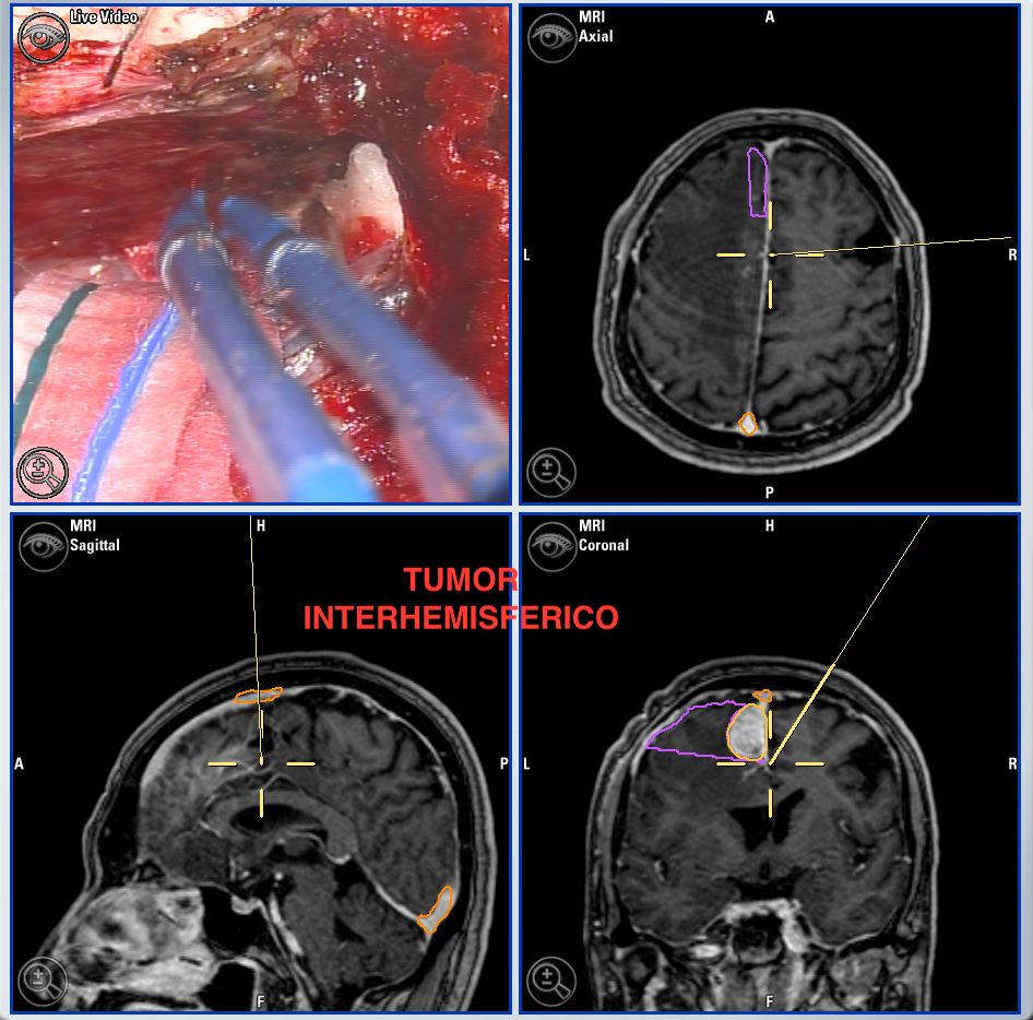 Enrique De Obieta Cruz-31