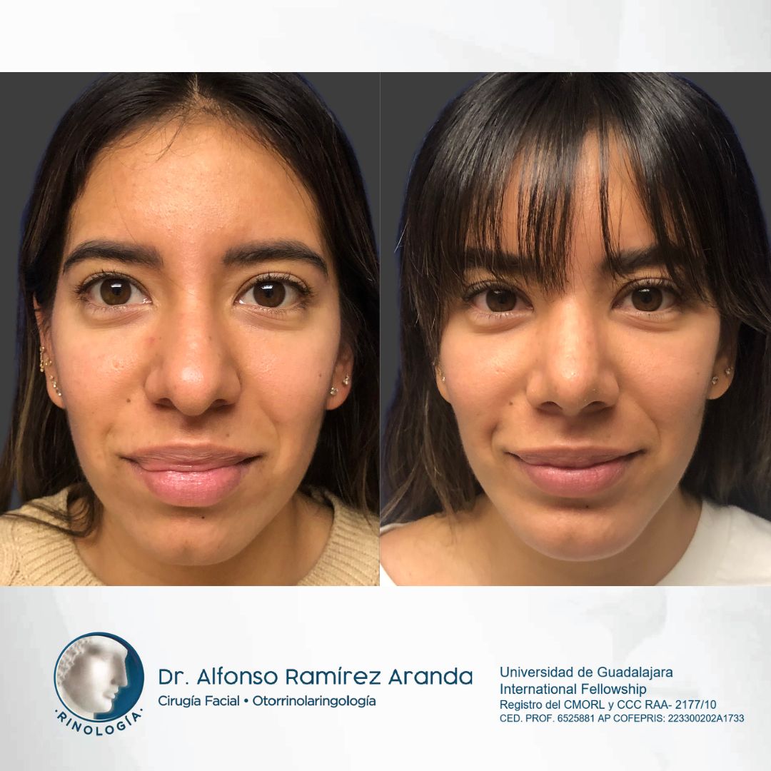 Alfonso Ramírez Aranda-35