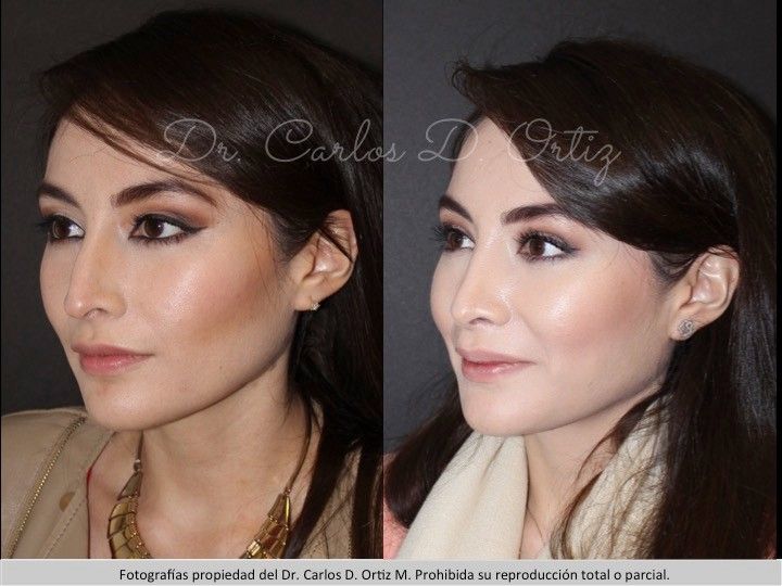 Carlos David Ortiz Moreno-67