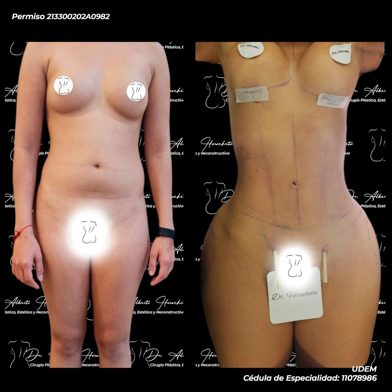 Alberto Hiracheta Torres-5