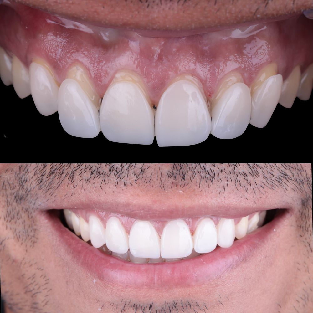 Laura Ceballos Brito-4