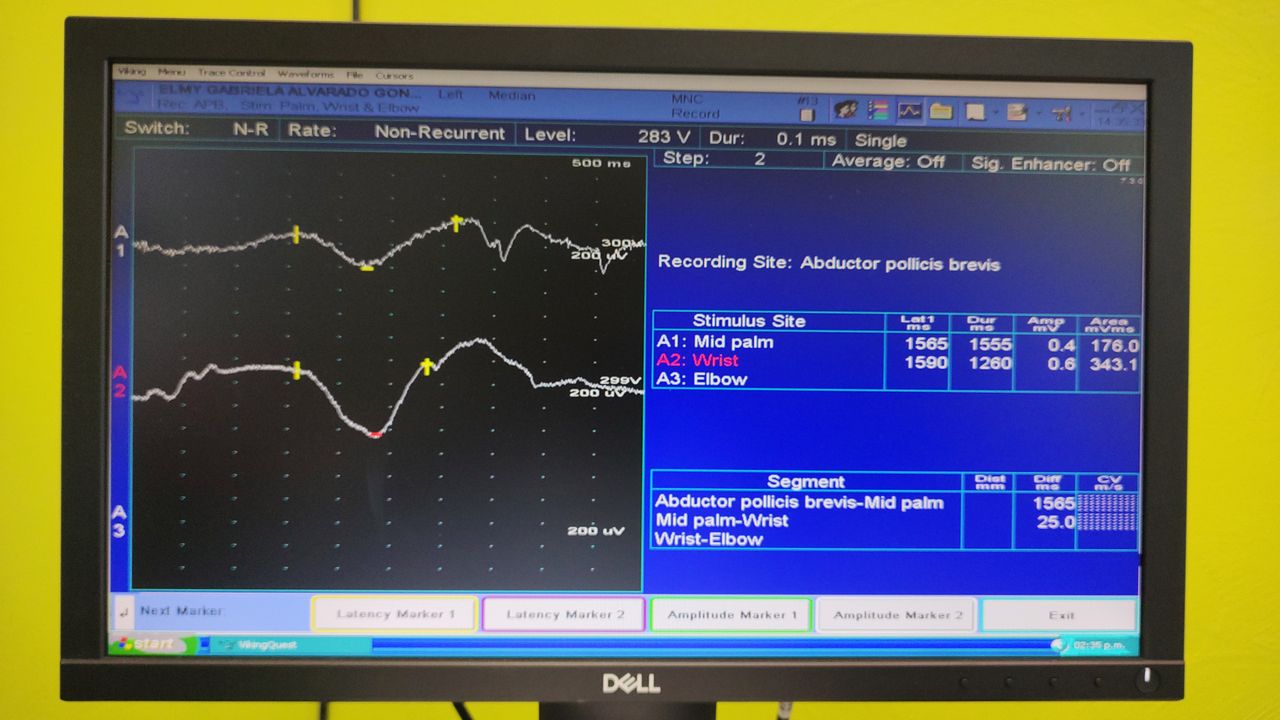 Lizeth Patricia Mena Rivas-31