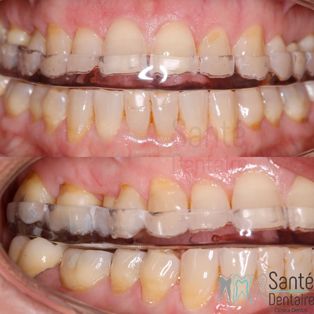 Daniel Oñate Robledo-37