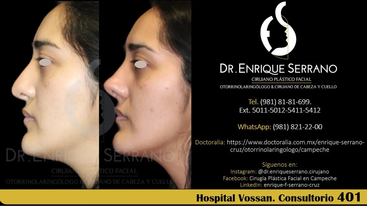 Enrique Serrano Cruz-92