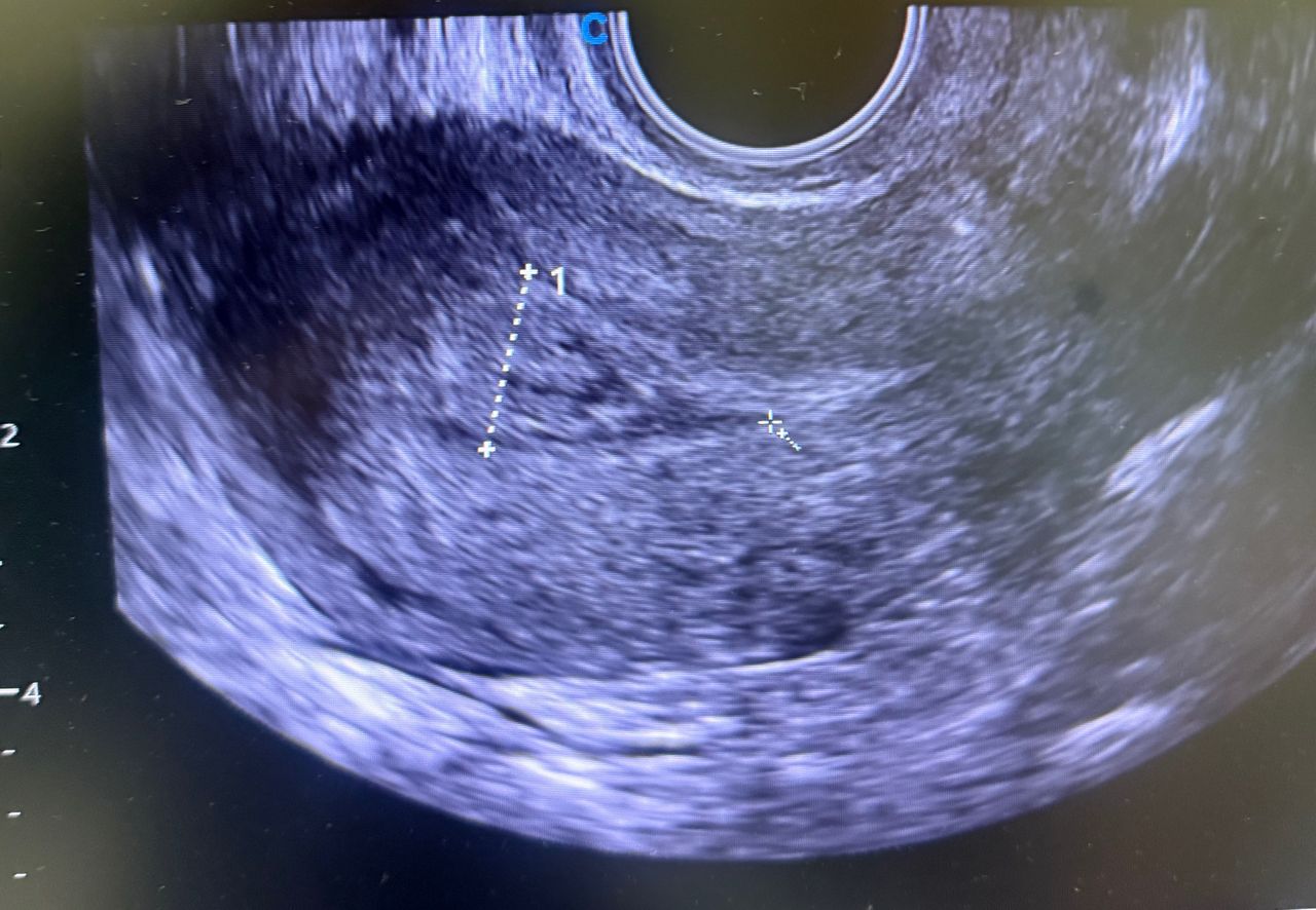 Mauricio Polanco Lepe-0