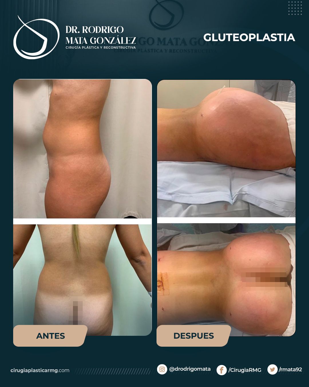 Rodrigo Mata Gonzalez-14