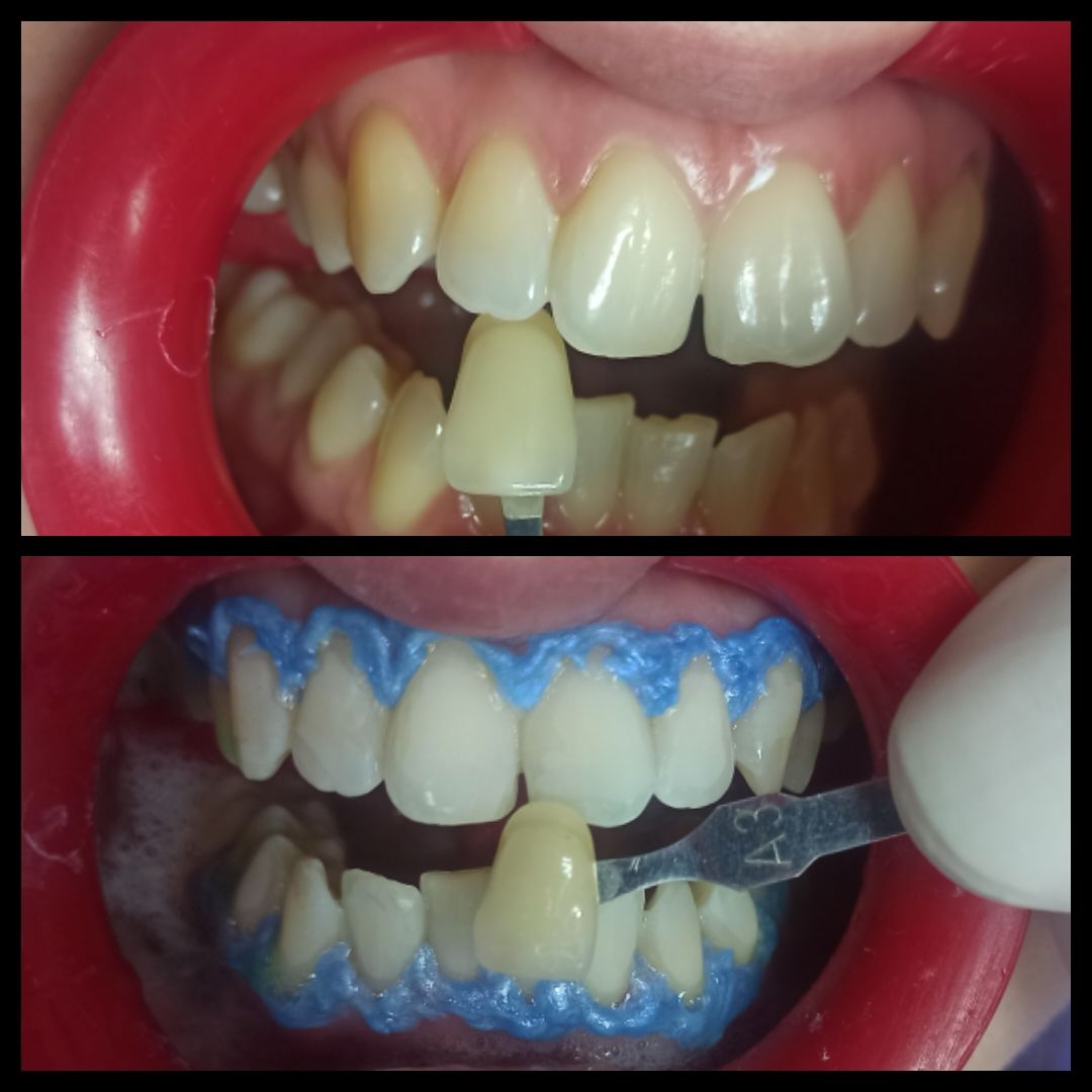 Oscar Cortez Perez-6