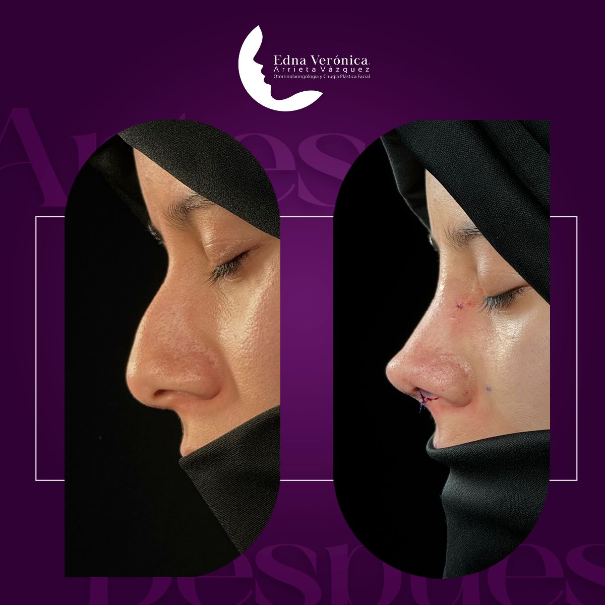 Edna Verónica Arrieta Vázquez-3