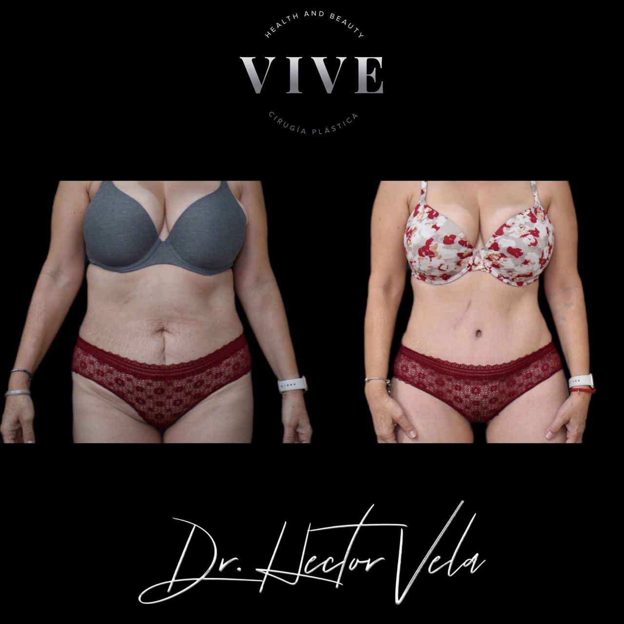 Héctor Eduardo Vela Cardona-113