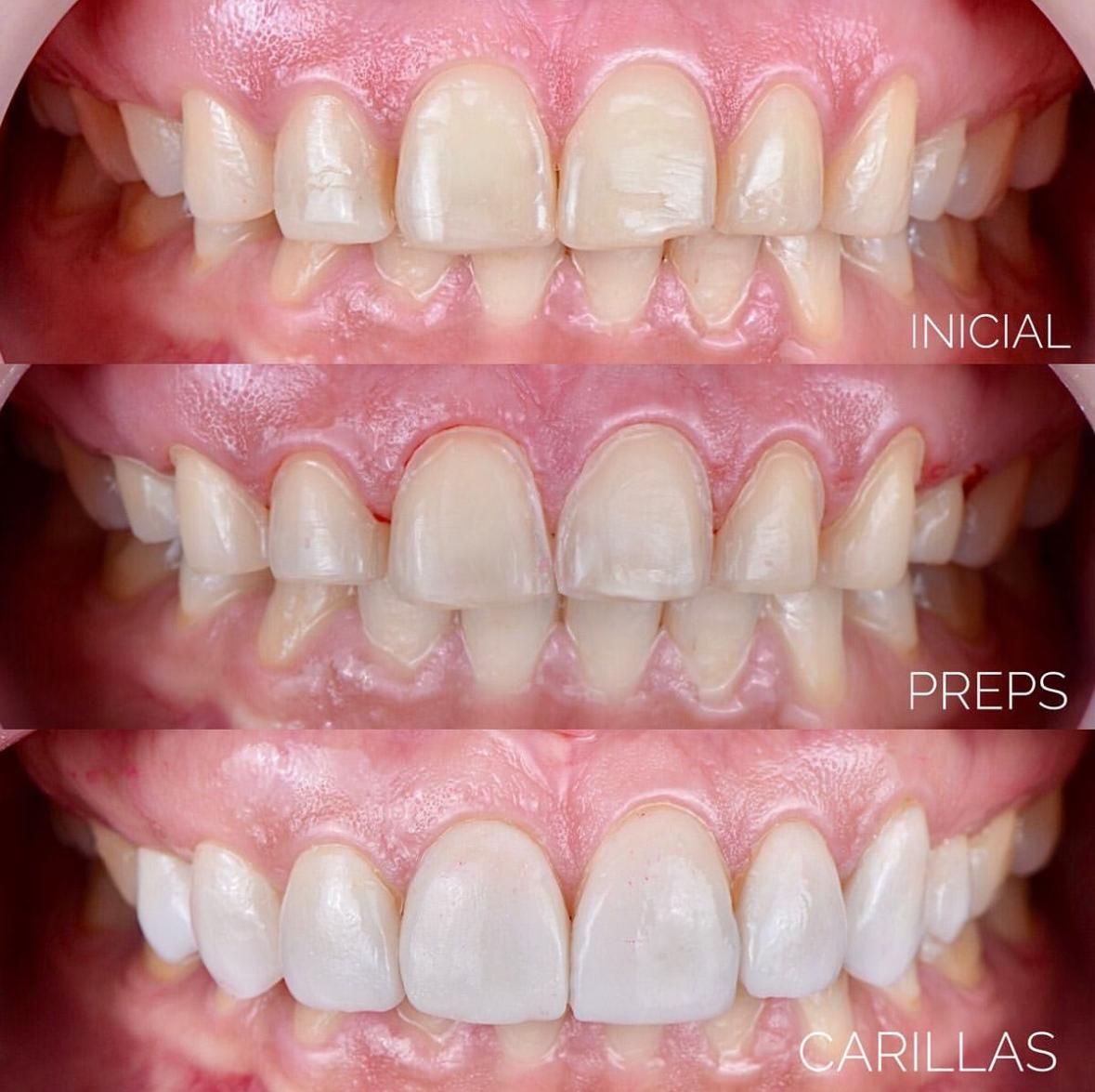 Luis Armando Mendívil Barreras-17