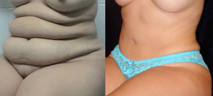 Edgar Ernesto Torres Mejía-7