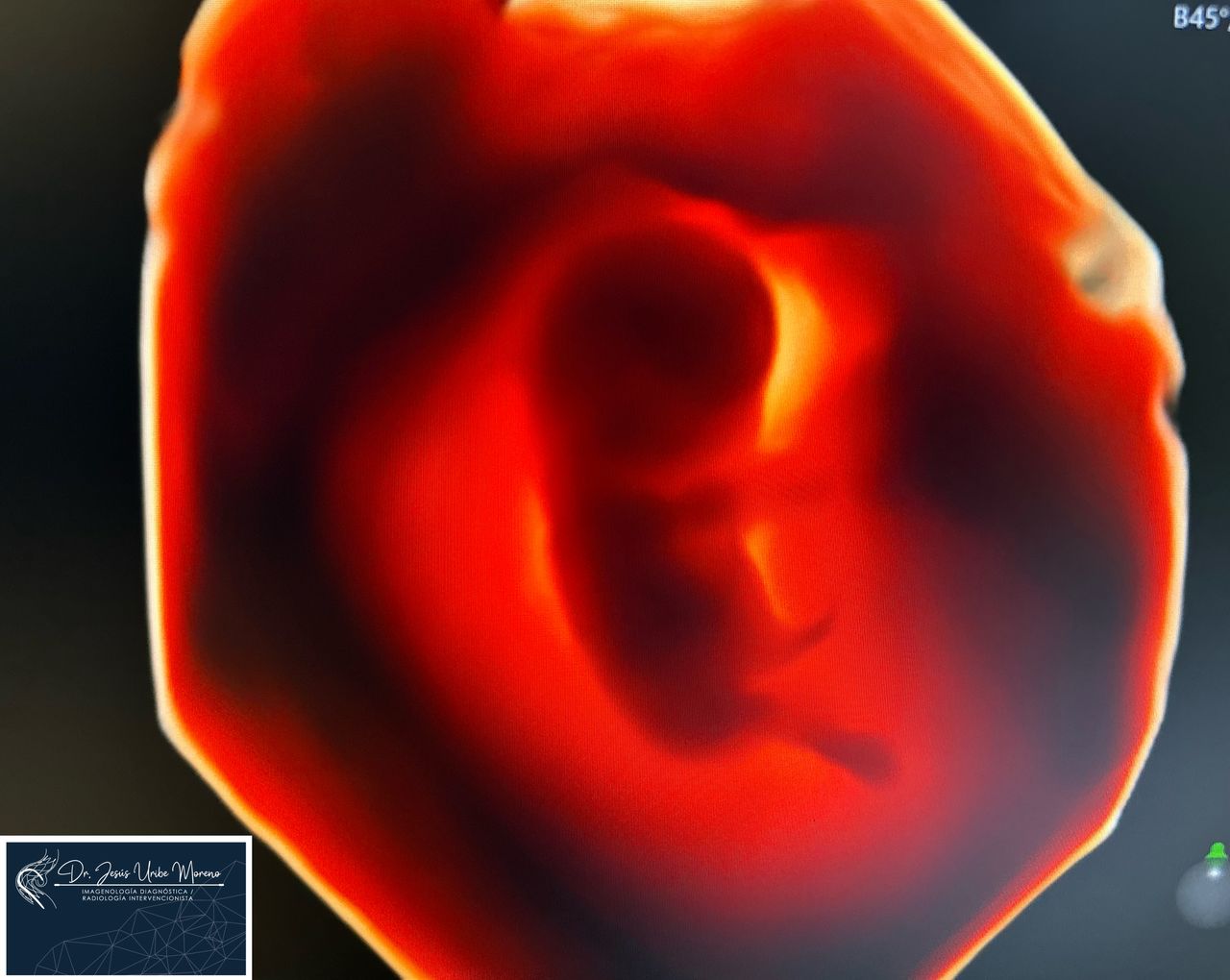 Jesus Uribe Moreno-6