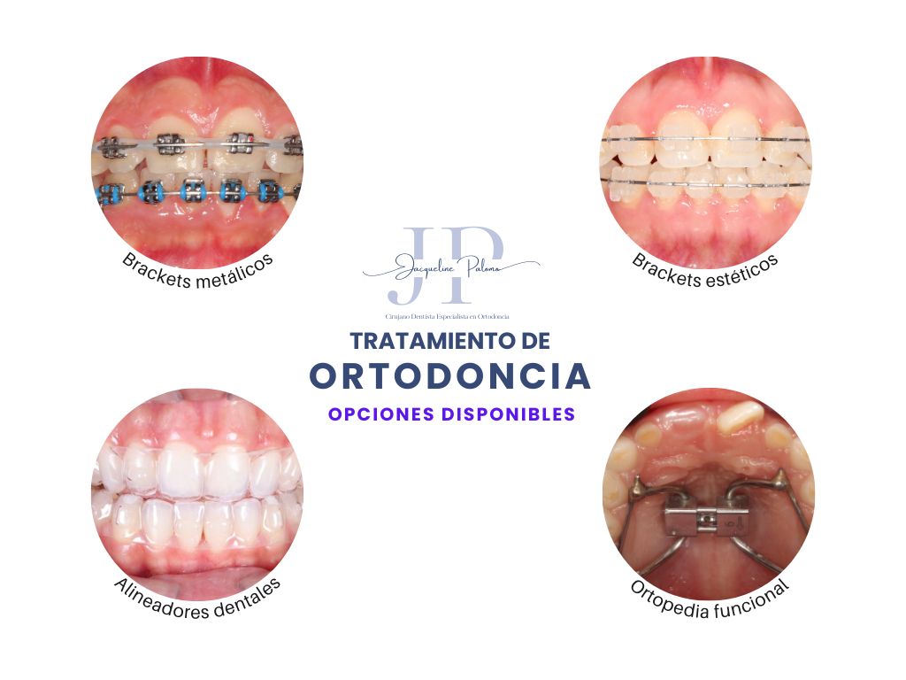 Jacqueline Palomo Meza-0
