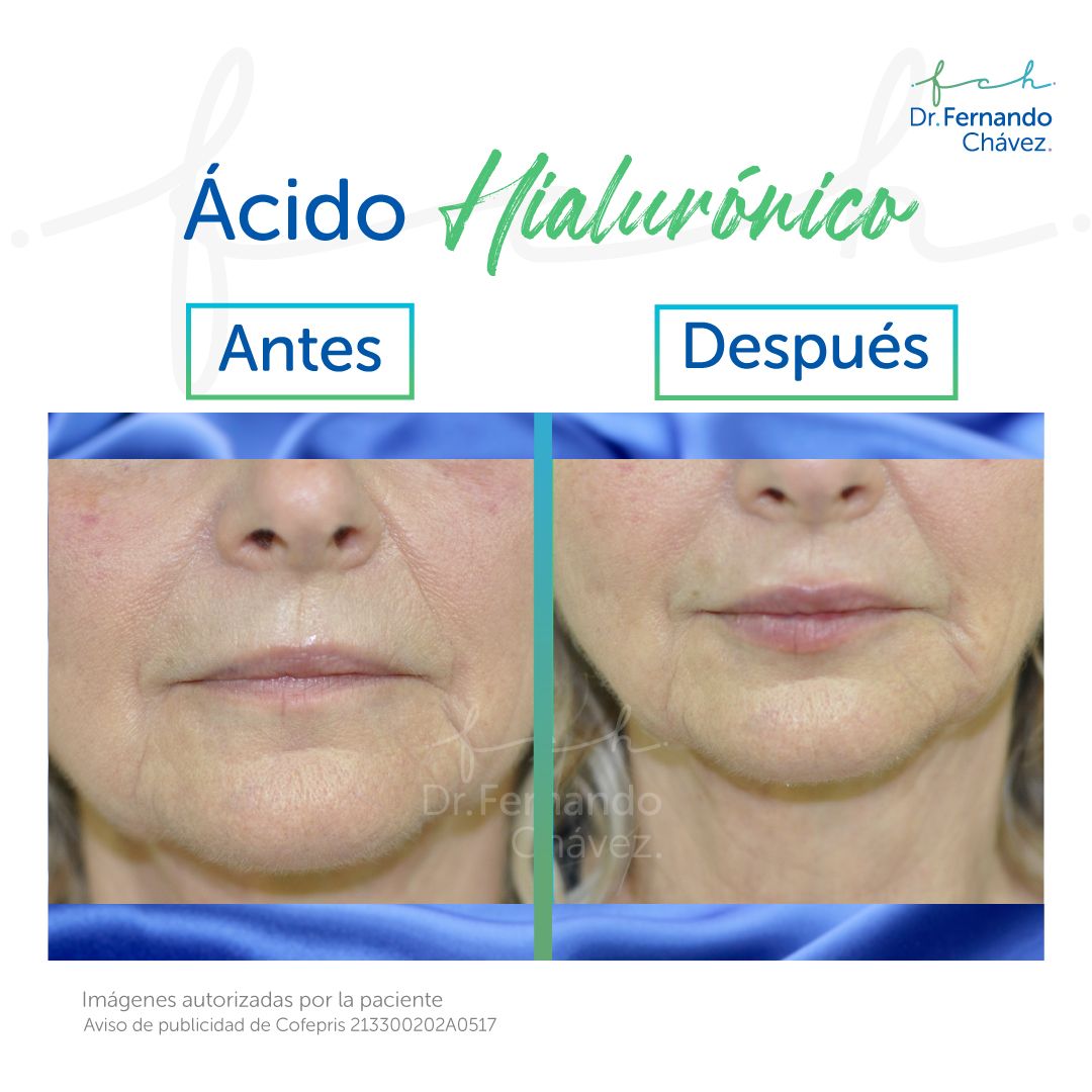 Fernando Chávez Osorio-15