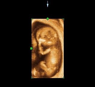 Karla Yadira López Castellanos-1