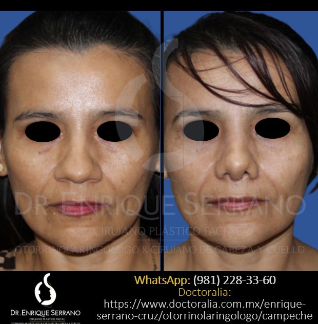 Enrique Serrano Cruz-53