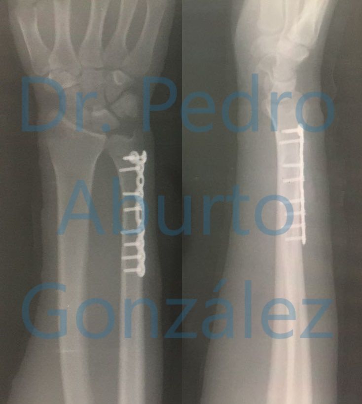 Pedro Aburto González-11