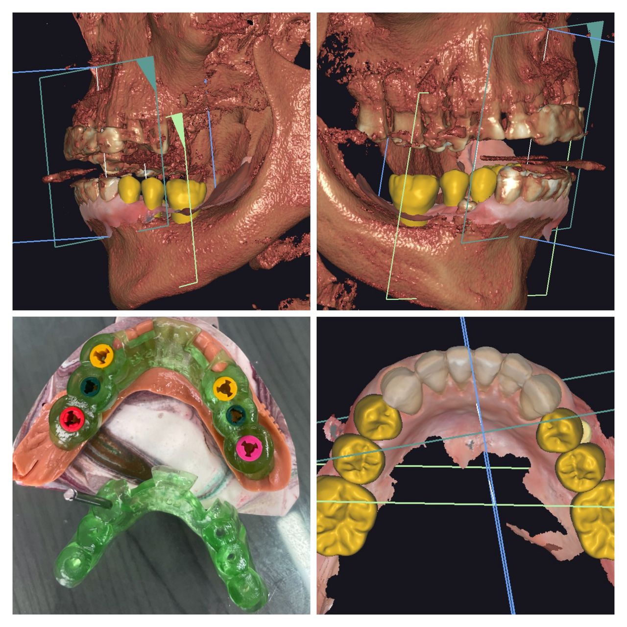 Jose David Torres Hernandez-13