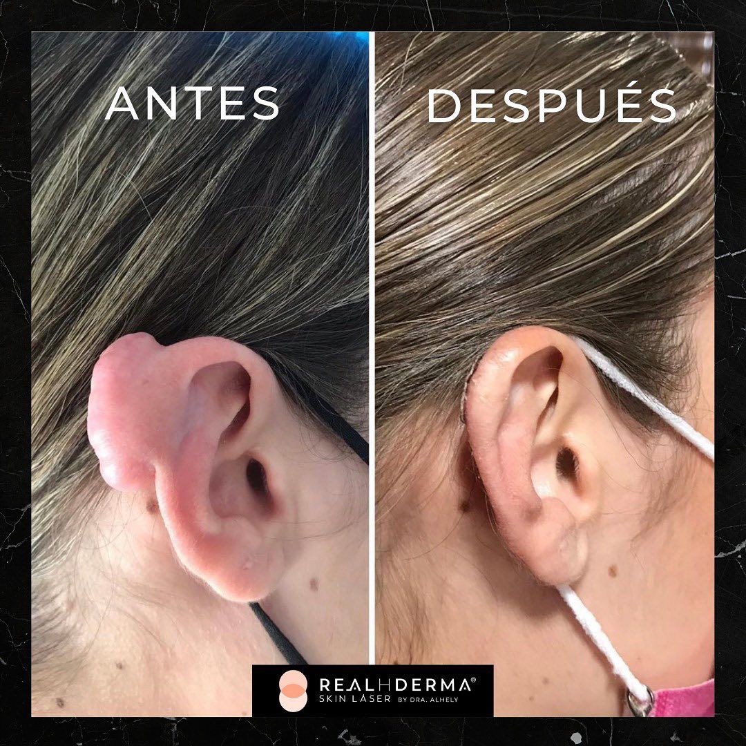 Laura Alheli Niebla Maldonado-13