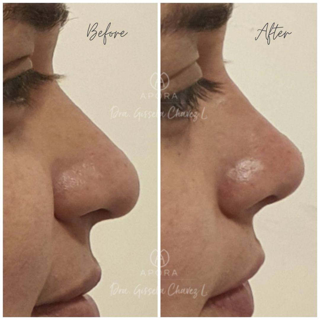 Gissela Chávez Lizardi-10