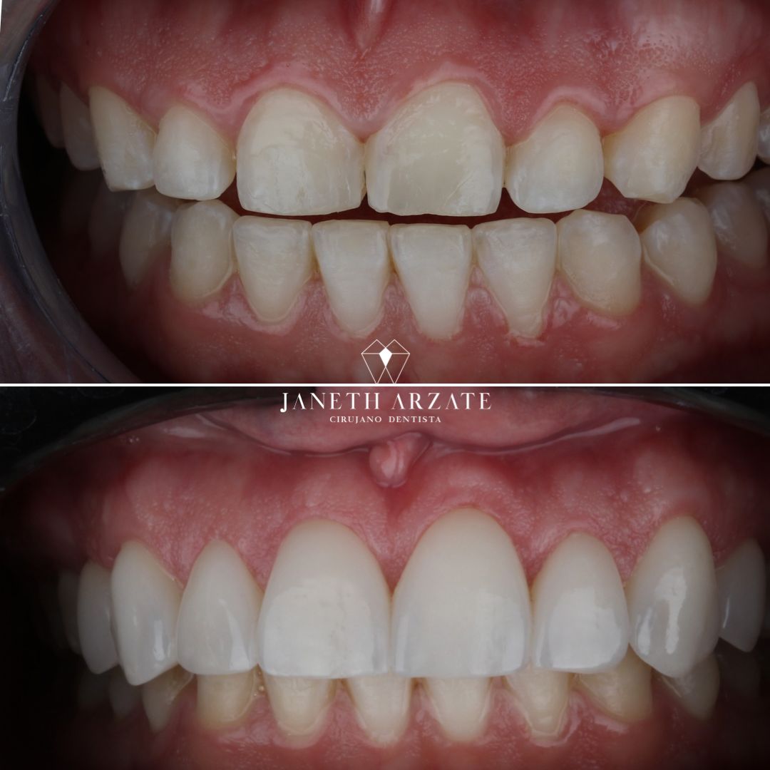 Janeth Arzate Banda-1