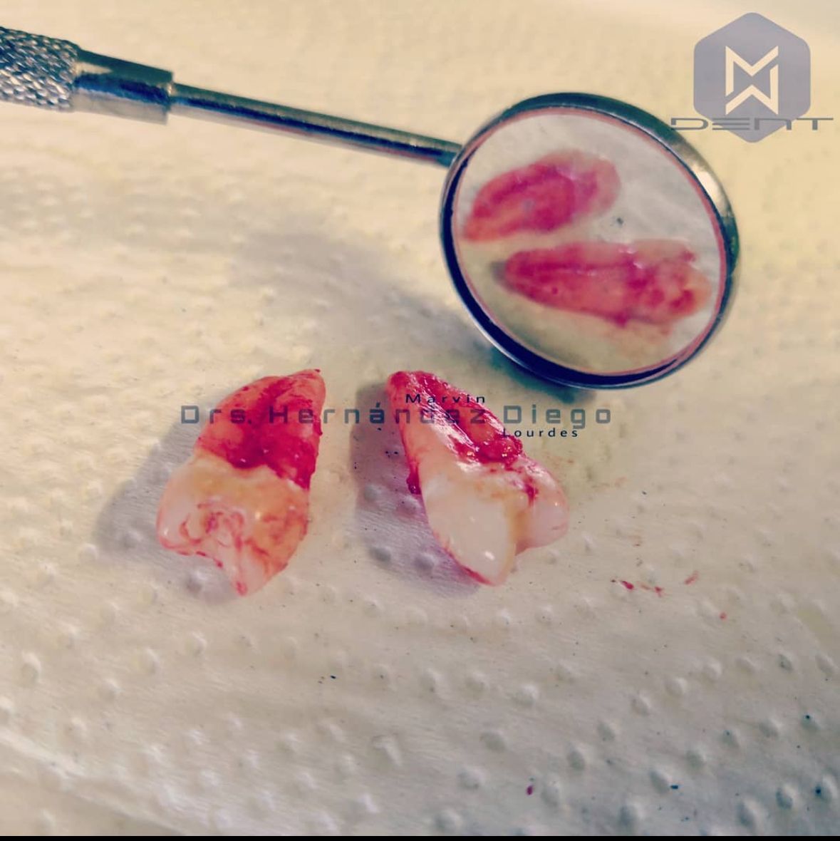 Marvin Adair Hernández Álvarez-43