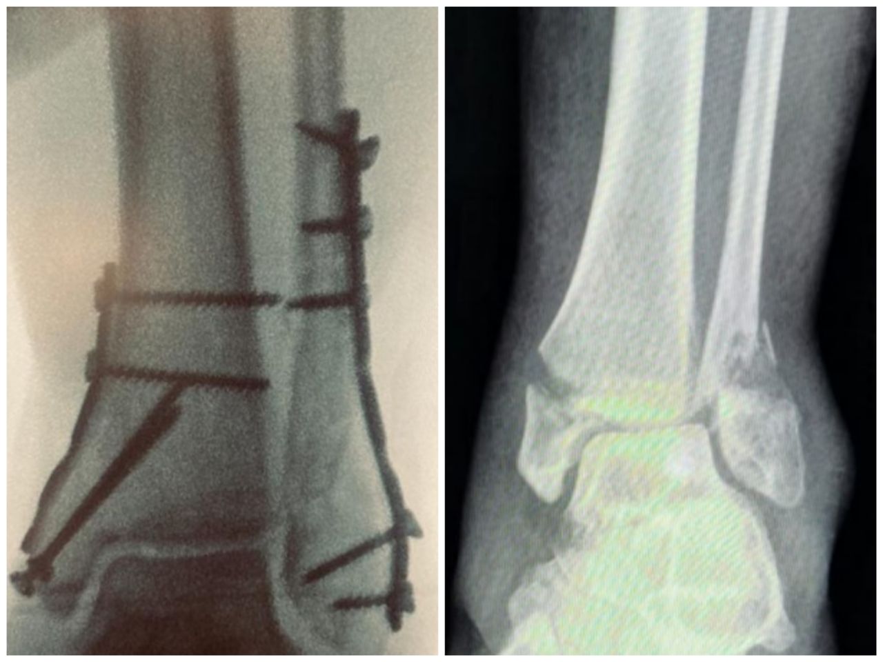 Gabriel De Leon Ochoa Lara-14