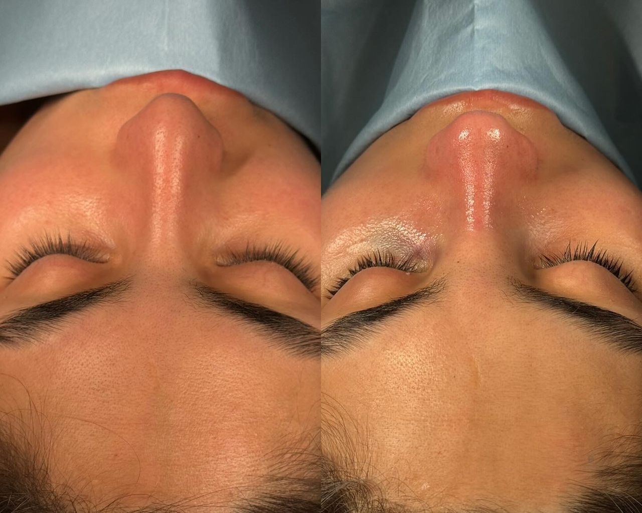 Angel Castro Urquizo-65