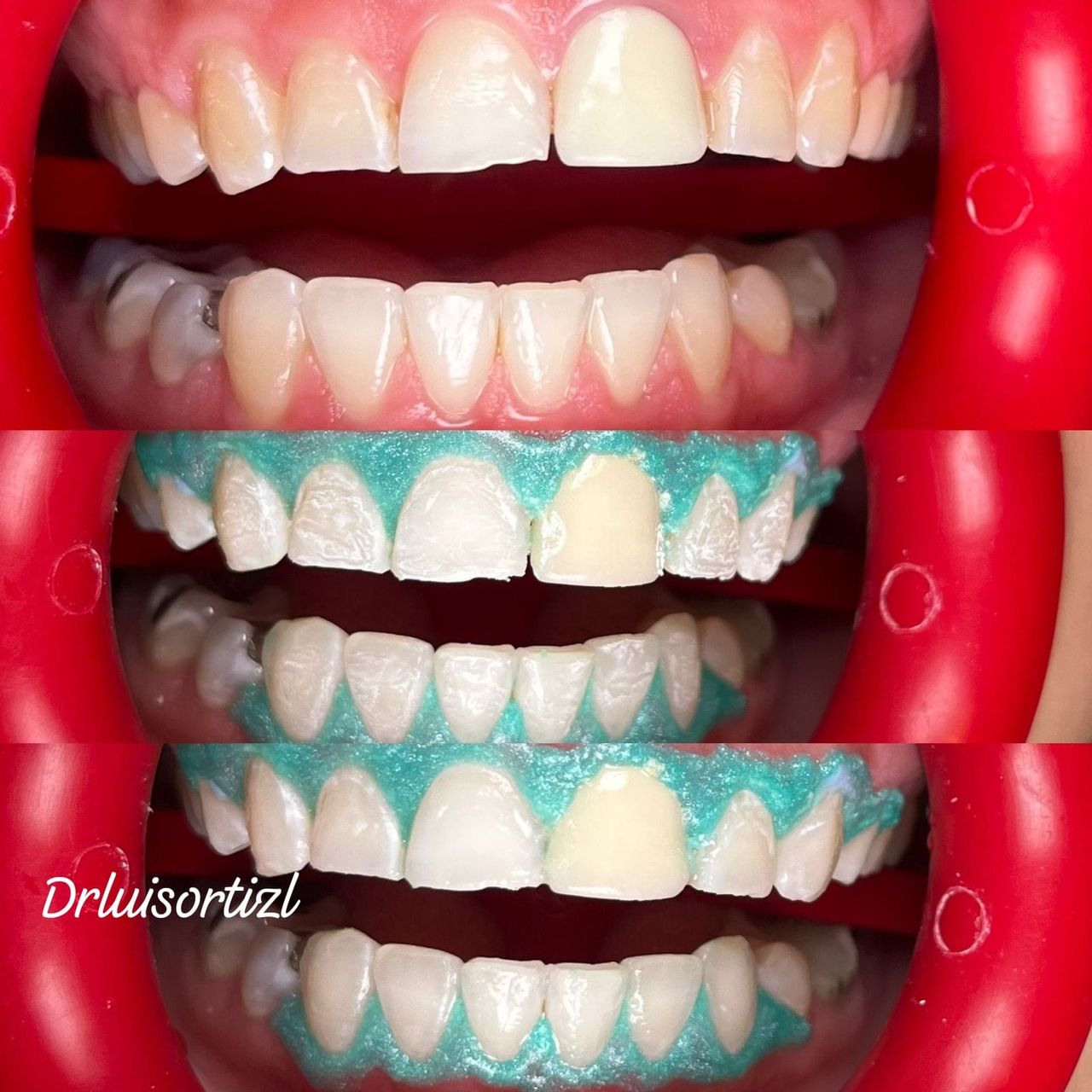 Luis Ángel Ortiz López-34