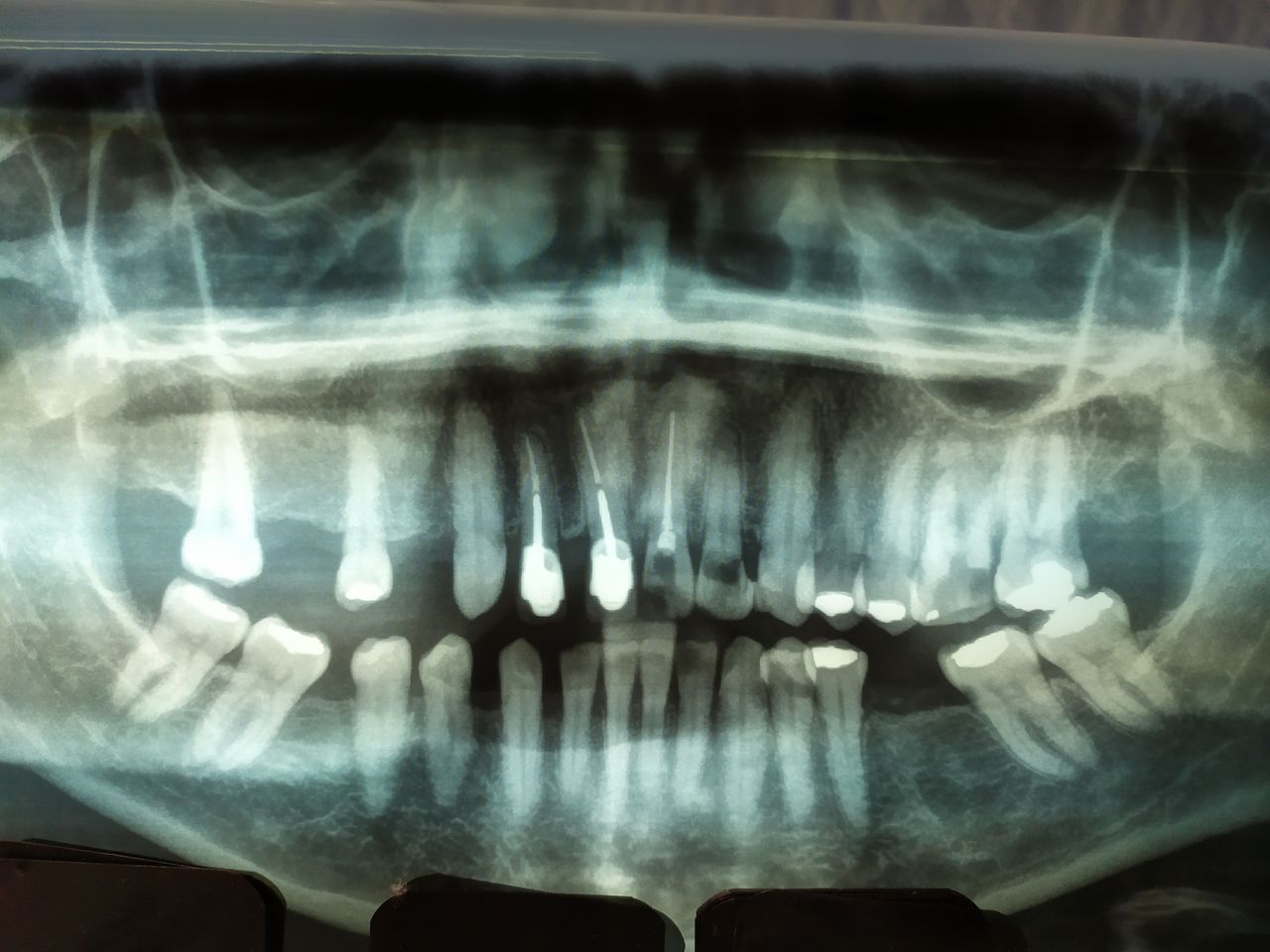 Oscar Cortez Perez-8