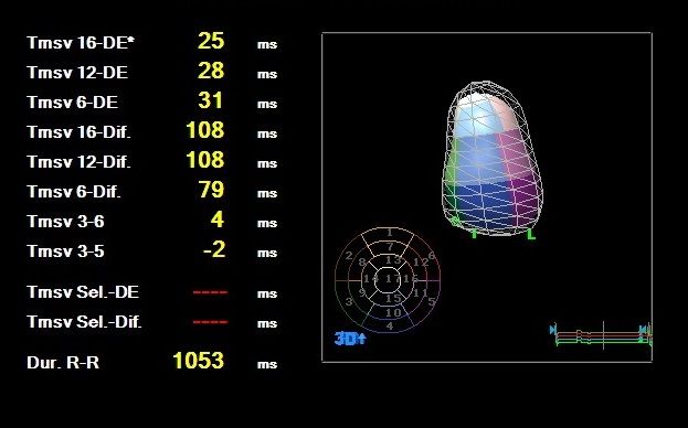 Heriberto Pruneda Ayala-15