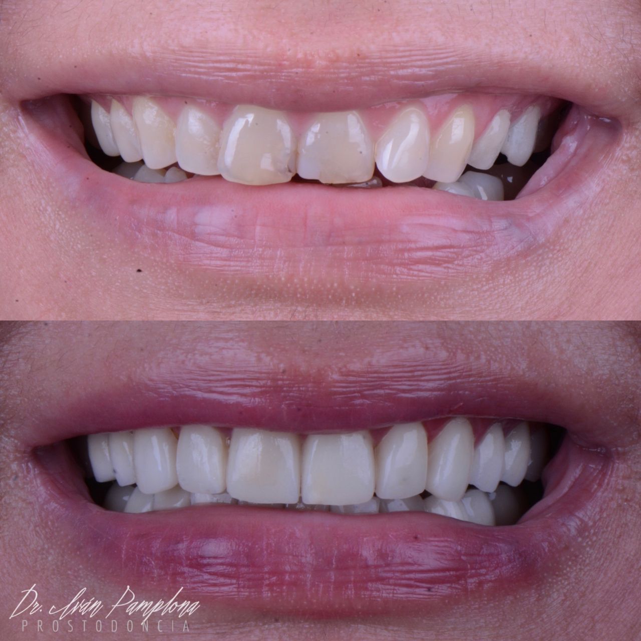 Iván Gerardo Pamplona Alfaro-13