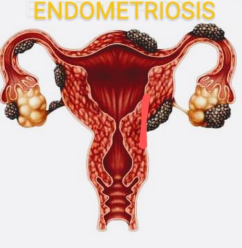 Ma. Del Carmen Hernández Ovando-0