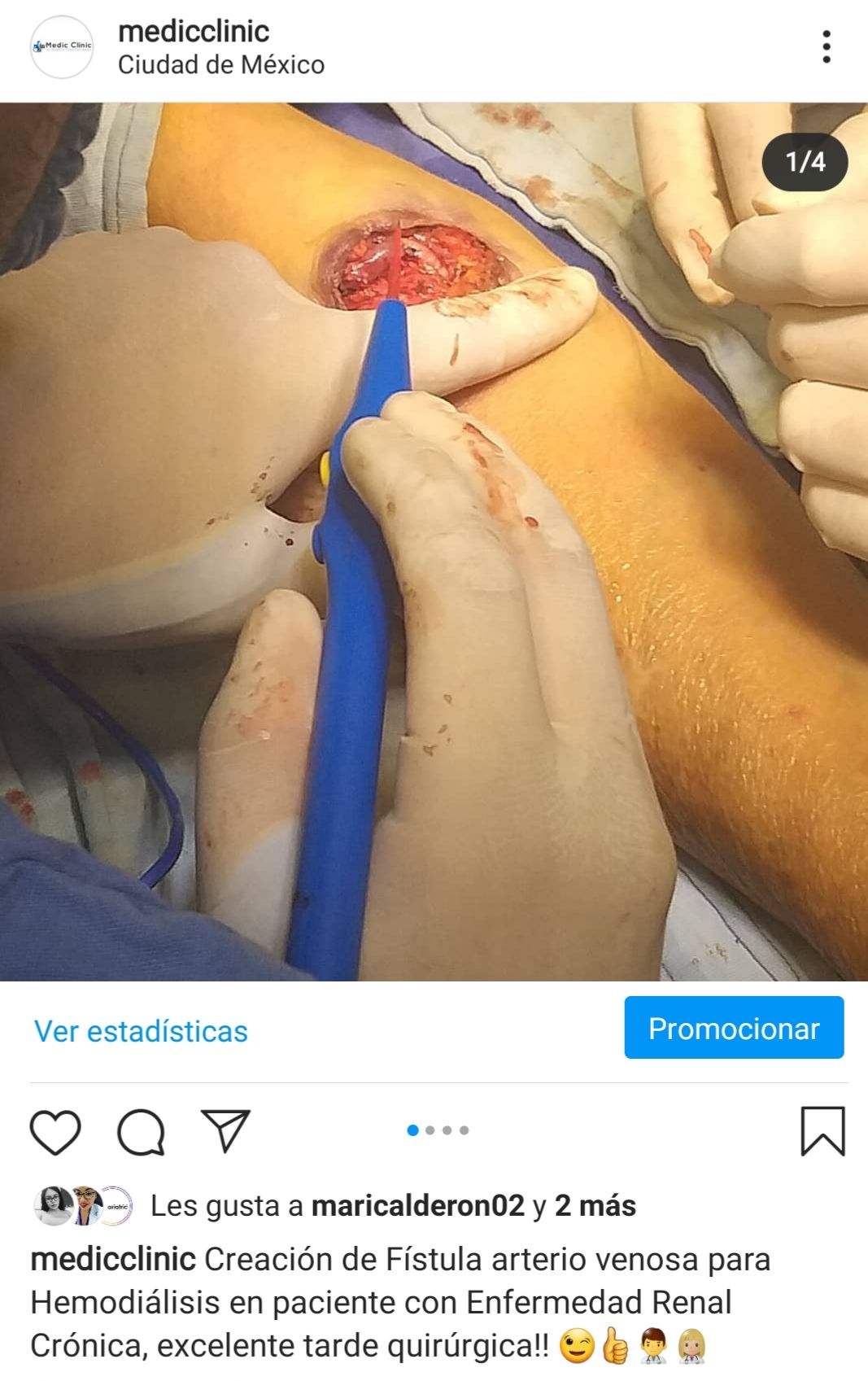 Rubén Bladimir Flores Hernández-5