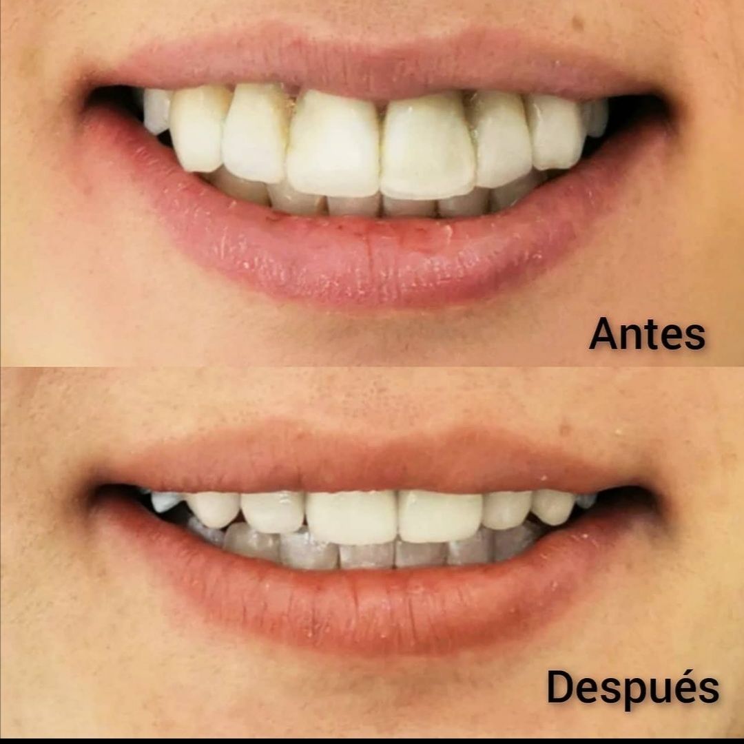 Ana Cecilia Chapa Kindling-24