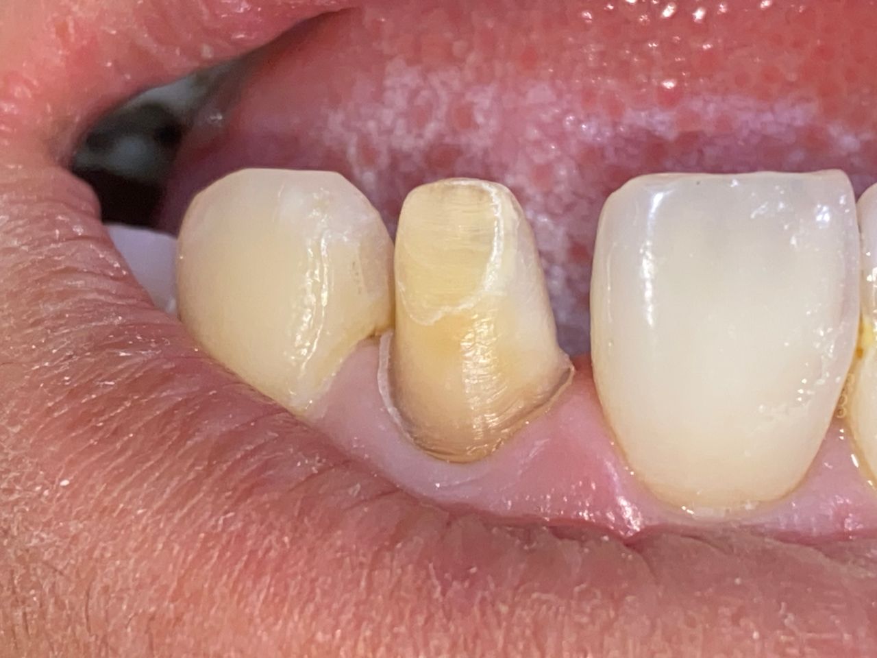 Raúl Méndez Cifuentes-29