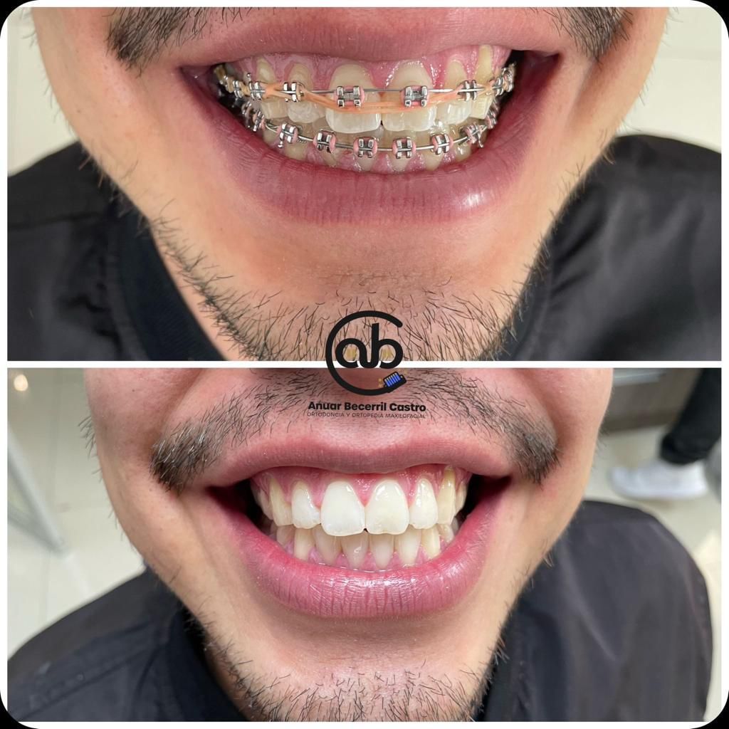 Anuar Becerril Castro-32