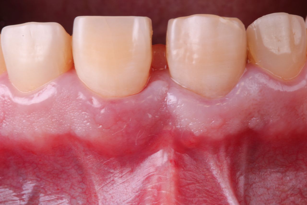 Hugo Enrique Aguilar Lamas-74