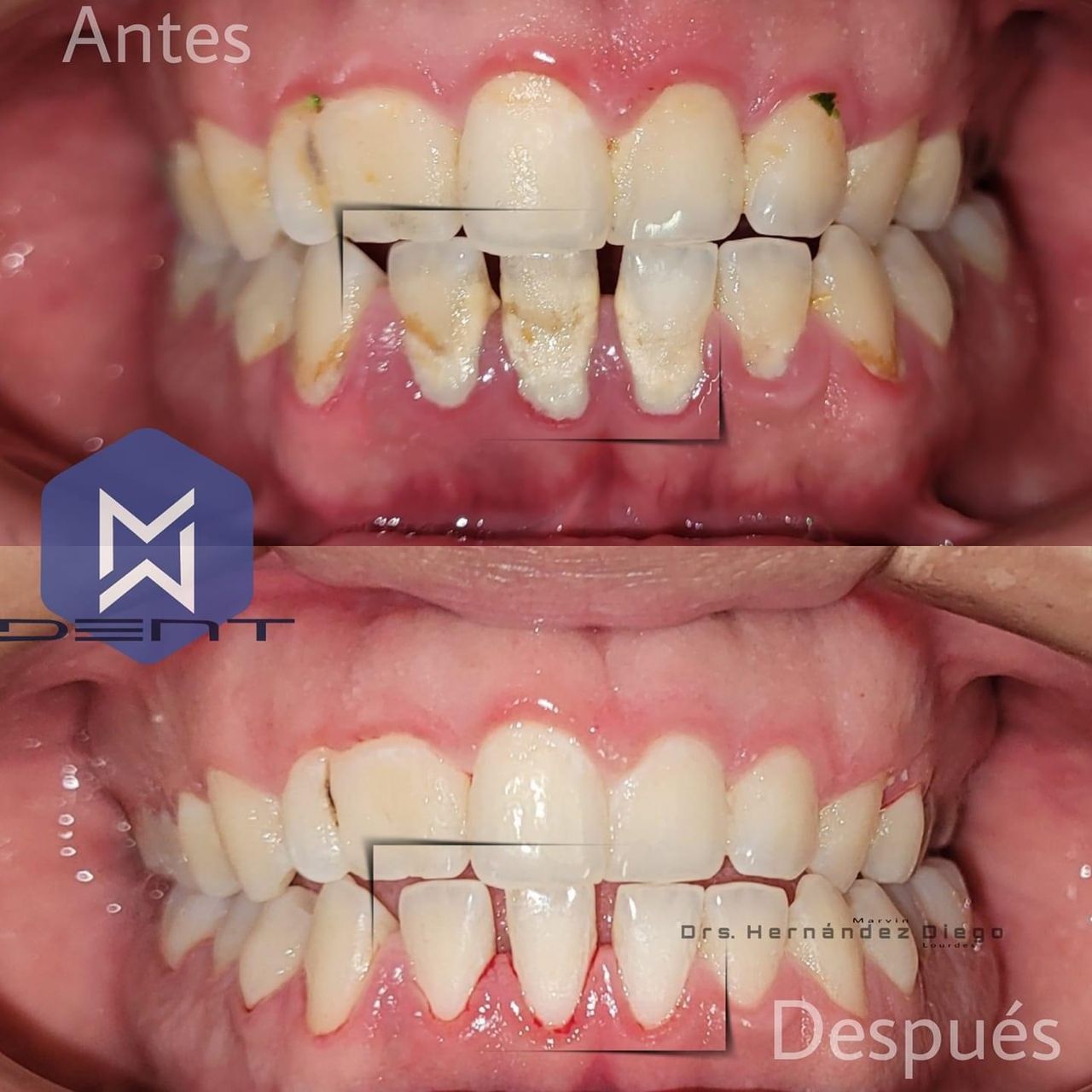 Marvin Adair Hernández Álvarez-44