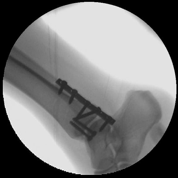 Rafael Adolfo Ferreyra Martinez-16