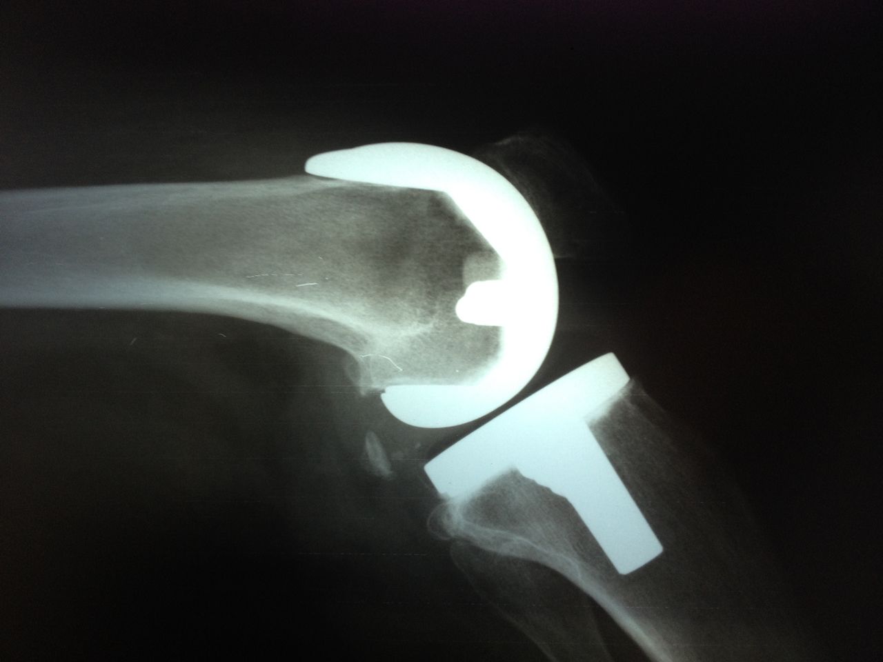 Benjamín Contreras Muñoz-3