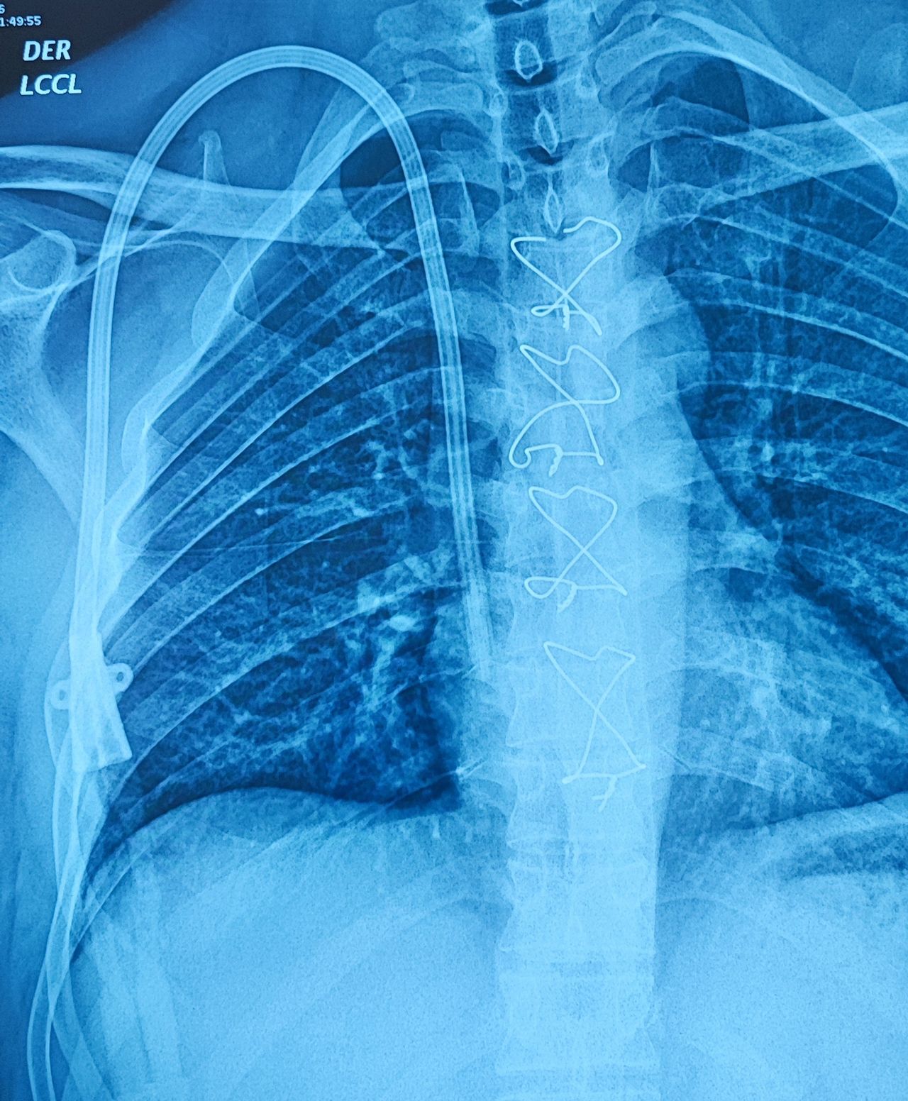 Krishna Marcos Escobar-13