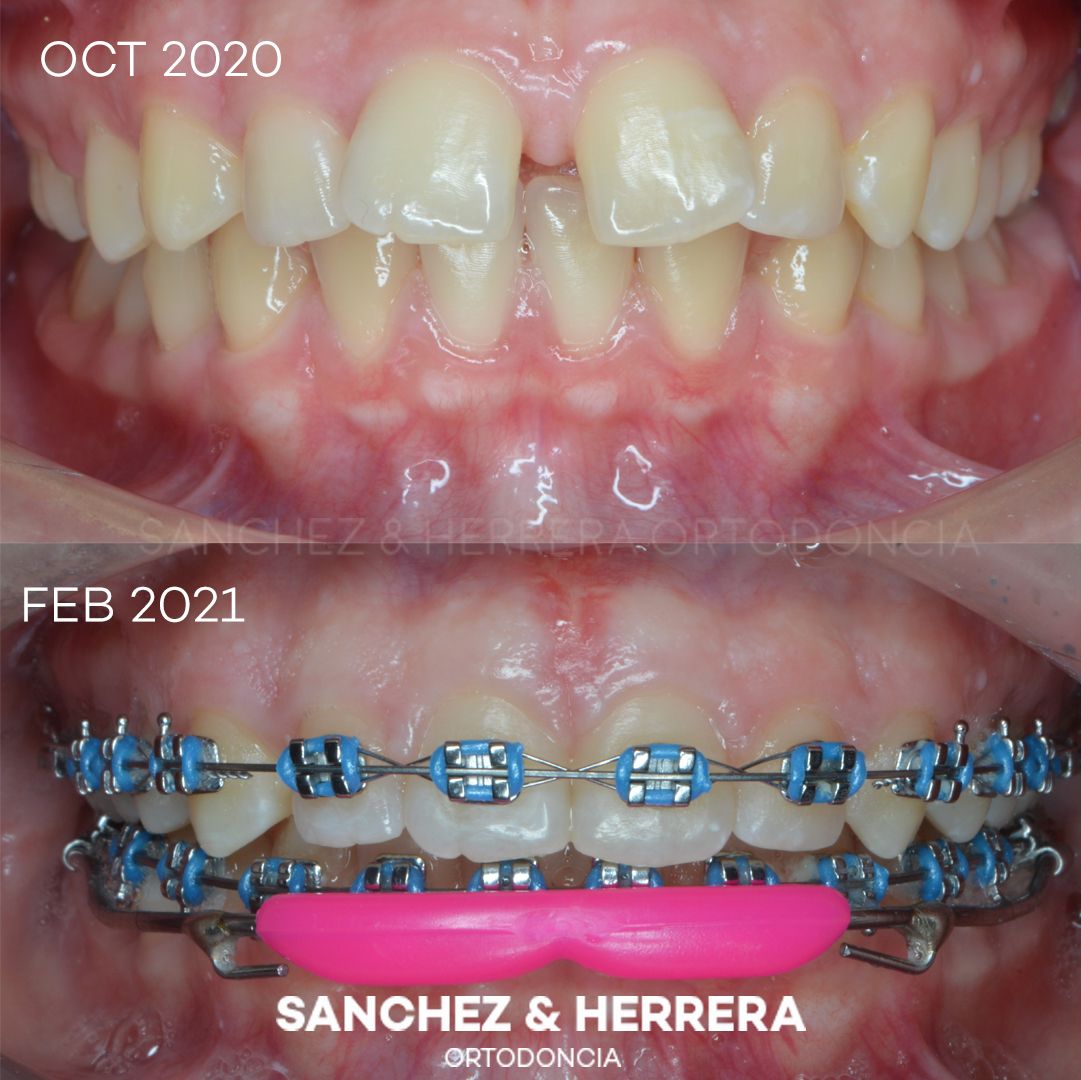 Daniel Sánchez Caamaño-9