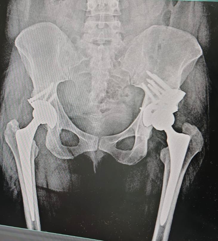 Alejandro Martínez Ramírez-41