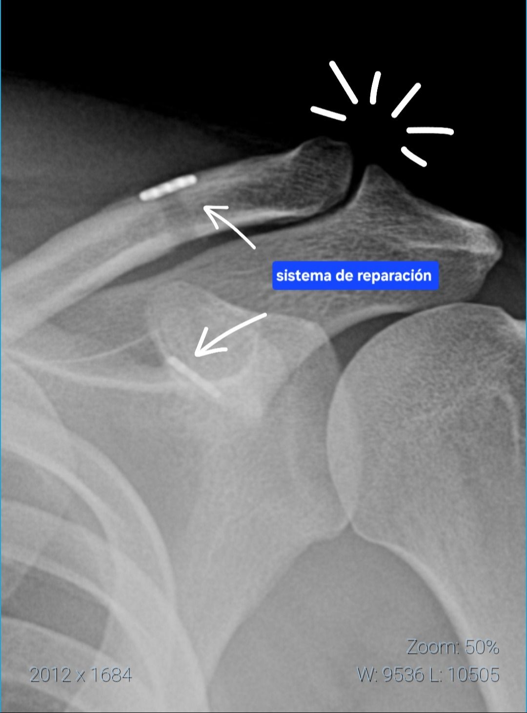 Juan Miguel Vargas Martínez-7