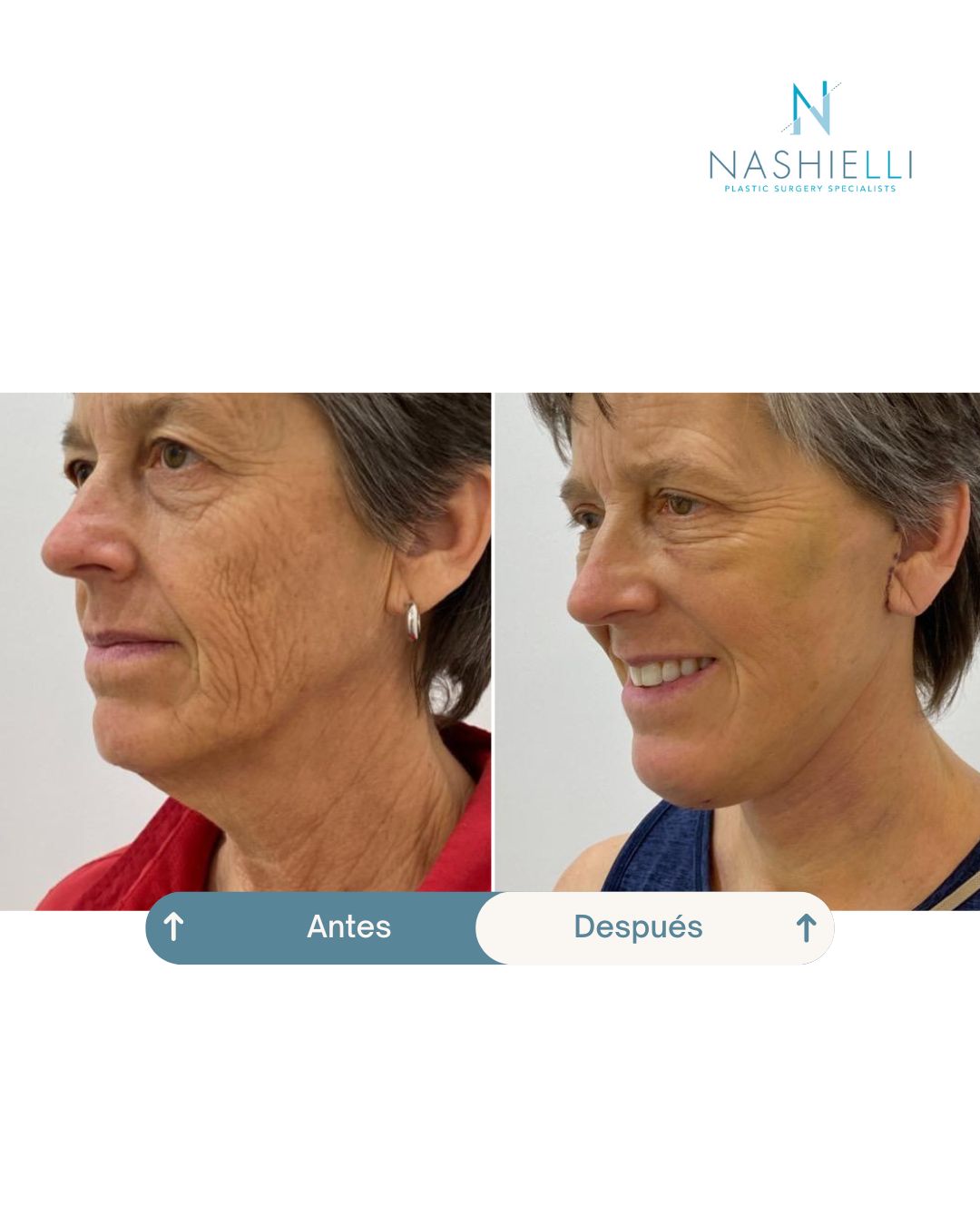 Nashielli Torres Espinosa Chiu-30