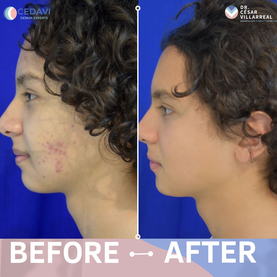 César Daniel Villarreal Villarreal-11